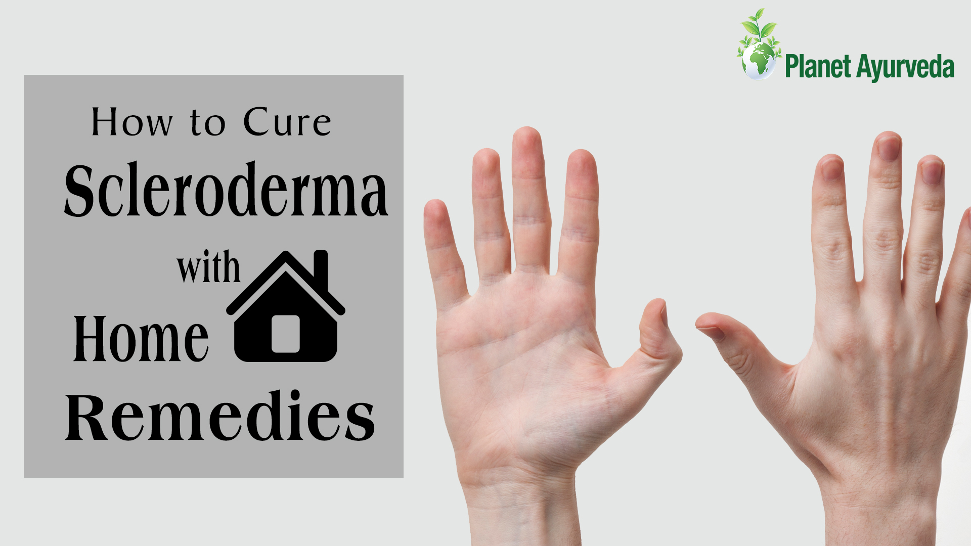 How to Cure Scleroderma with Home Remedies