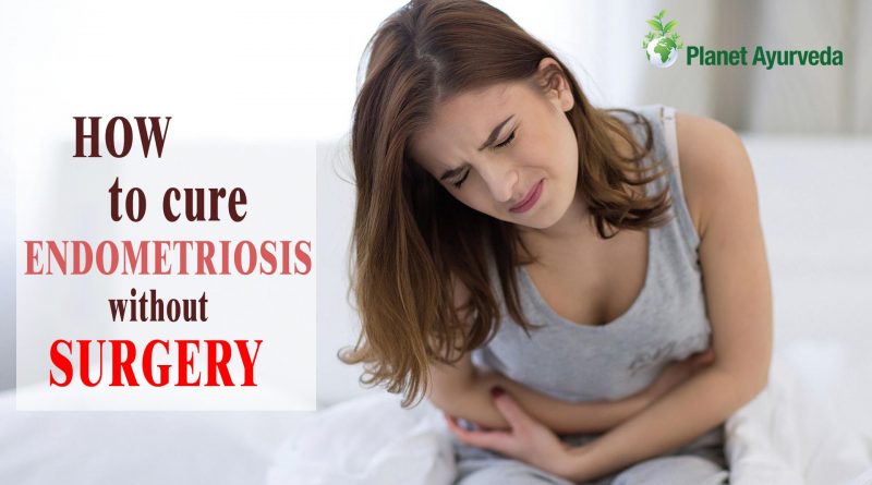 How to cure endometriosis without surgery