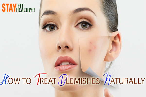 HOW TO TREAT BLEMISHES NATURALLY