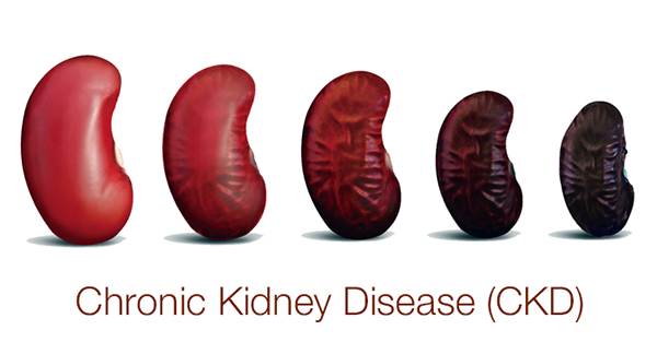 Kidney Disease