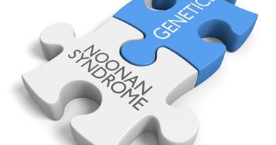 Noonan syndrome, Genetic disorder