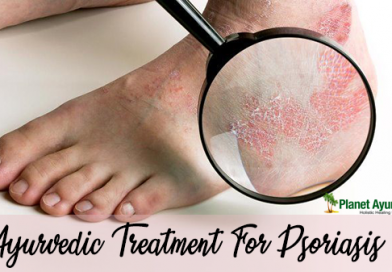 Psoriasis skin