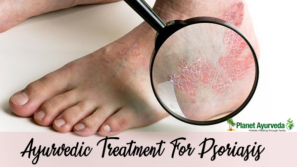 Psoriasis skin