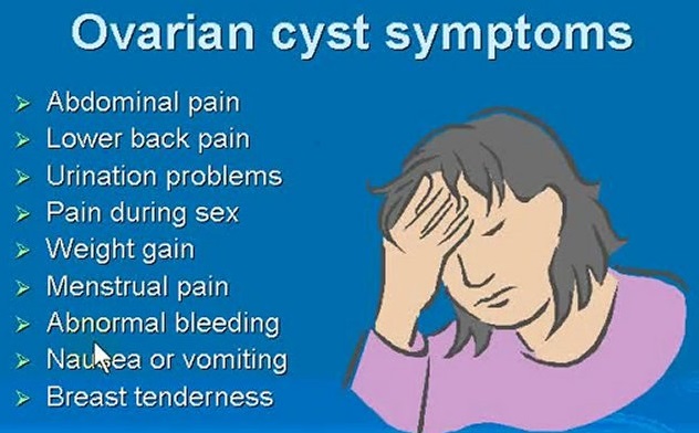 Symptoms of Ovarian cysts