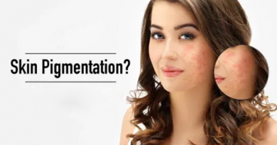 Skin Pigmentation