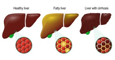 fatty-liver