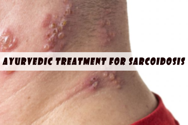 Ayurvedic Treatment For Sarcoidosis