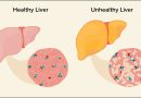 Clinically Tested Ayurvedic Support for Fatty Liver Health Fatty Liver