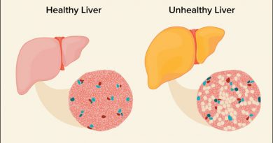 Fatty Liver