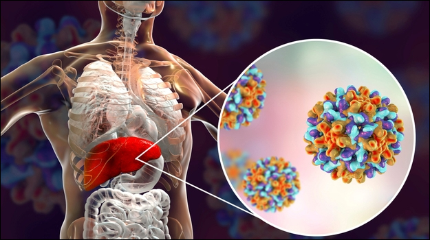 Hepatitis B
