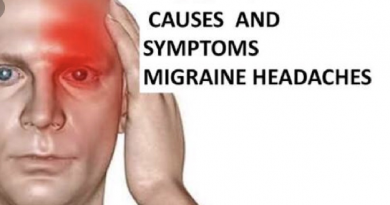 migraine