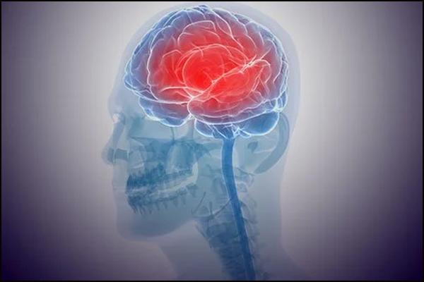 Encephalitis