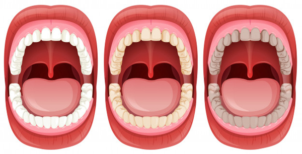 Symptoms of Poor Oral Health