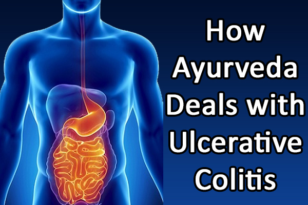 Watch Video Possible Treatment of Ulcerative Colitis in Ayurveda - Patient Review from Goa