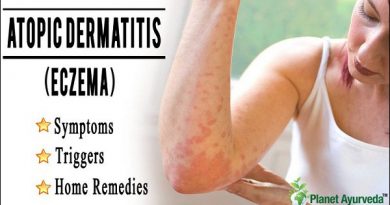 Ayurvedic Treatment for Atopic Dermatitis Ayurvedic Treatment of Atopic Dermatitis