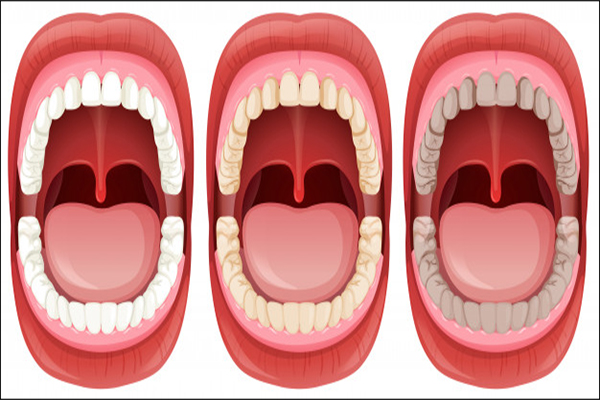 Oral Health
