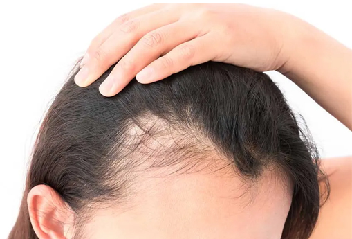 Herbal Remedies for Hair Growth Archives - Planet Ayurveda