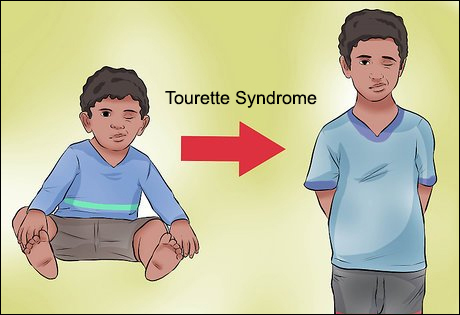 Tourette Syndrome