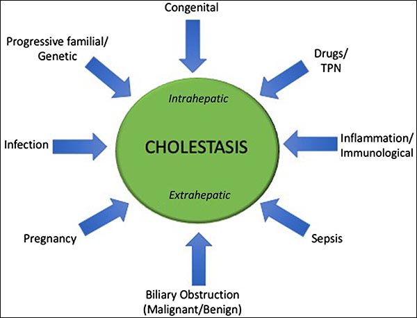 cholestasis