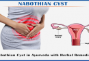 Treatment of Nabothian cyst in Ayurveda with Herbal Remedies