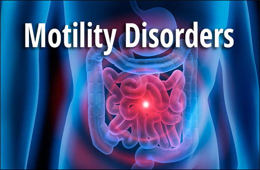 Esophageal Motility Disorder