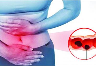 Alternative Treatment For Intestinal Tuberculosis With Herbal Remedies