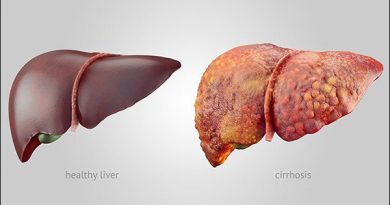 liver diseases