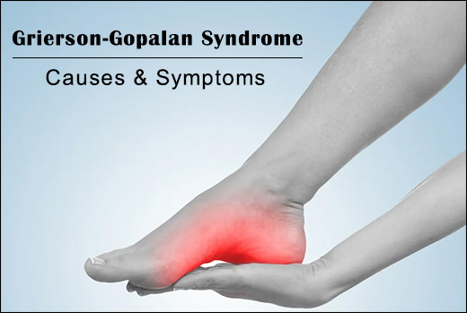 Grierson-Gopalan Syndrome