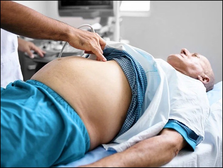 Abdominal Cocoon Problems 