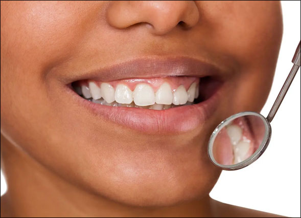 Gum recession