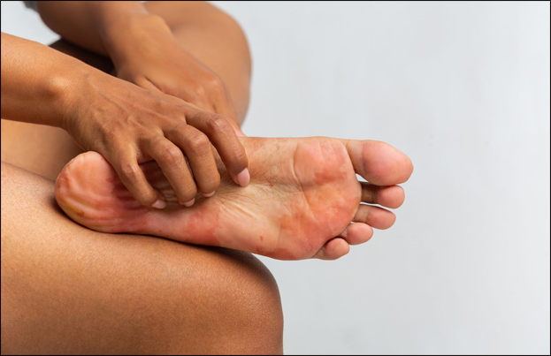vasculitic neuropathy