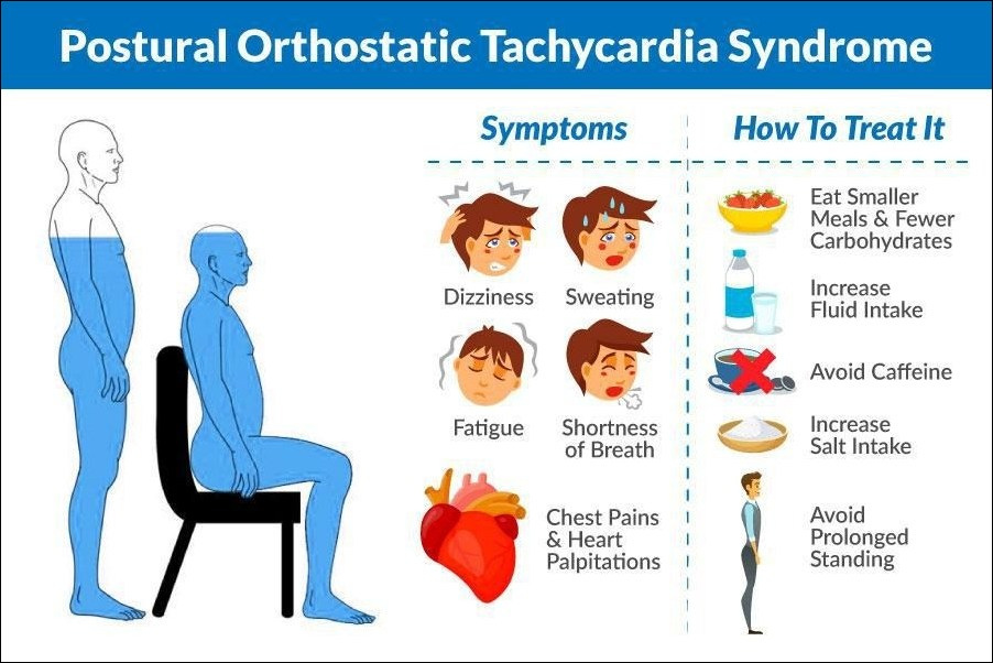 Postural Orthostatic Tachycardia Syndrome 