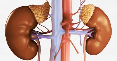 Hyperaldosteronism/ Conn's Syndrome