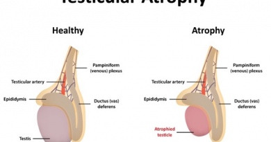 Testicular Atrophy