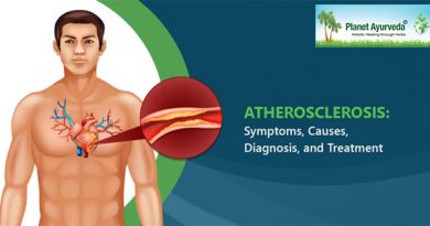 Treatment of Arteriosclerosis in Ayurveda