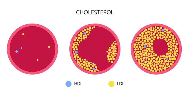 cholesterol-blood-