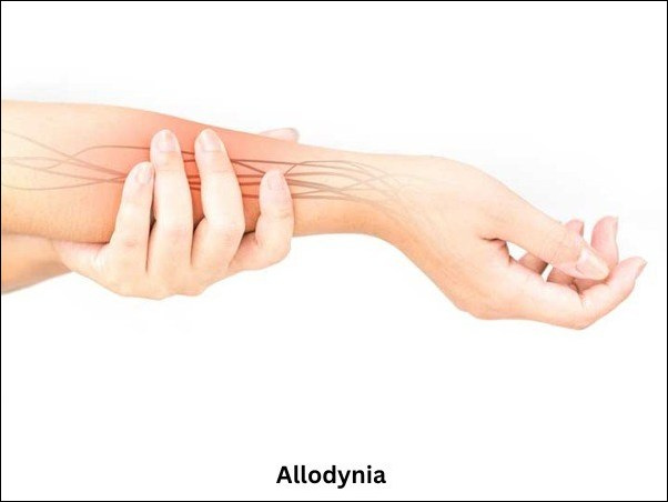 Allodynia