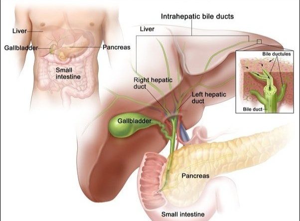Progressive Familial Intrahepatic Cholestasis-(PFIC-2)