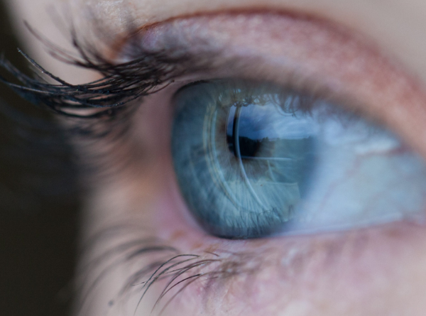 Ocular Surface Disease (OSD)