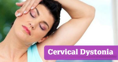 Cervical Dystonia