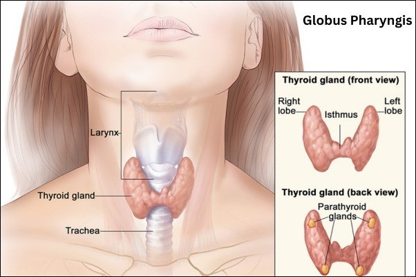 Globus Pharyngis 