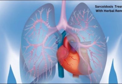 Sarcoidosis