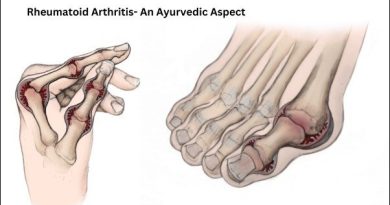 Rheumatoid Arthritis