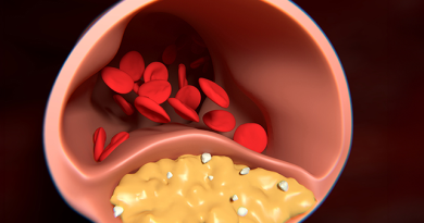 Are Cholesterol and Triglycerides the Same?- Understanding the Difference Triglycerides and Cholesterol