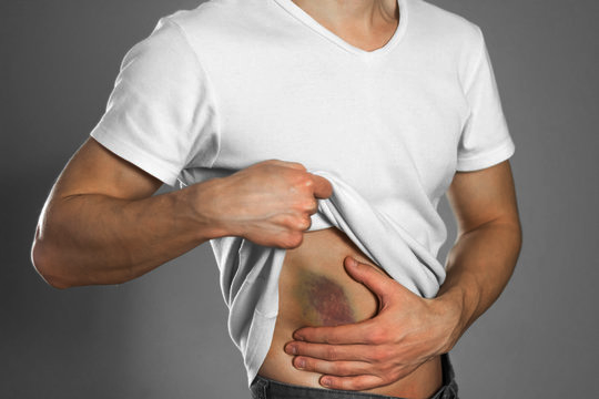 Chronic liver disease