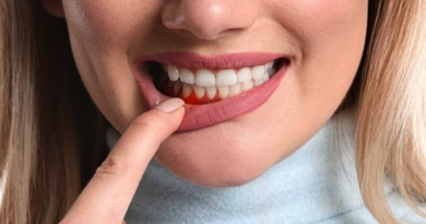 gingivitis