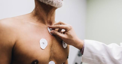 nuclear cardiac stress test