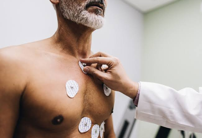 nuclear cardiac stress test