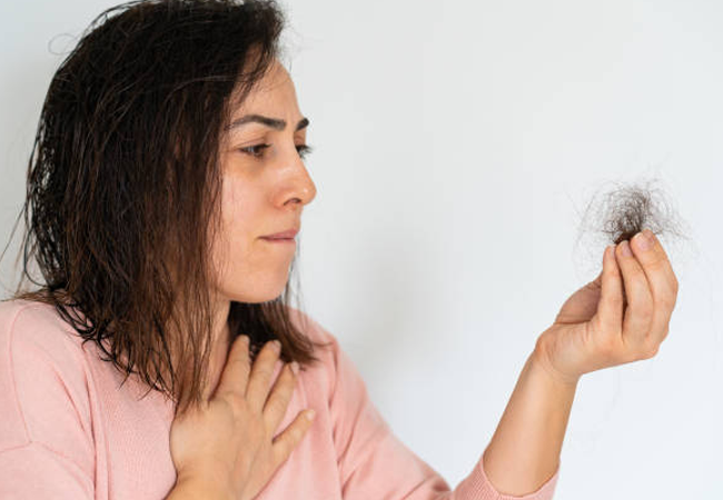 Hair Loss Hair Loss