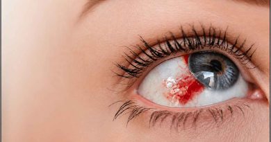 Hemorrhagic-Disorders